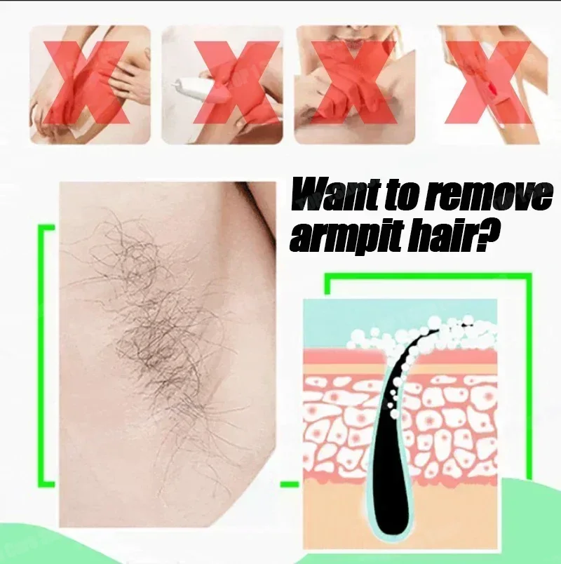 Hair Removal Spray Powerful Ha - Hair Care Korean Products 评论和价格