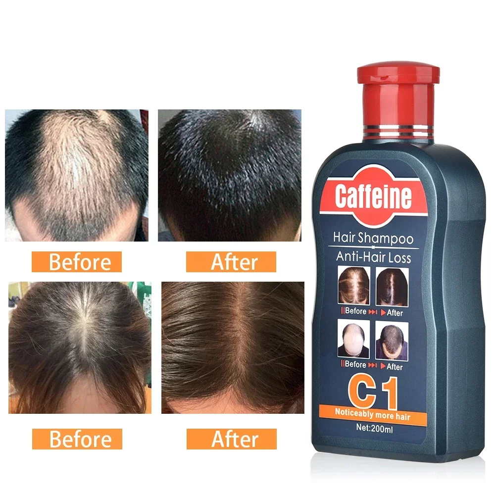 Men Shampoo For Hair Growth Na - Hair Care Korean Products 评论和价格
